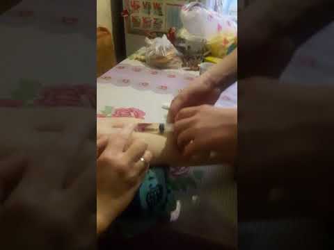 Внутривенная инъекция глюконат кальция  медбрату 14 лет