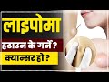 Lipoma in nepali  easy treatment of lipoma  swasthya sandesh