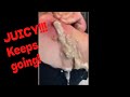 Juicy cyst pops and explosions pop ups