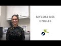 Vlogue 12  lonychomycose explique par une podiatre