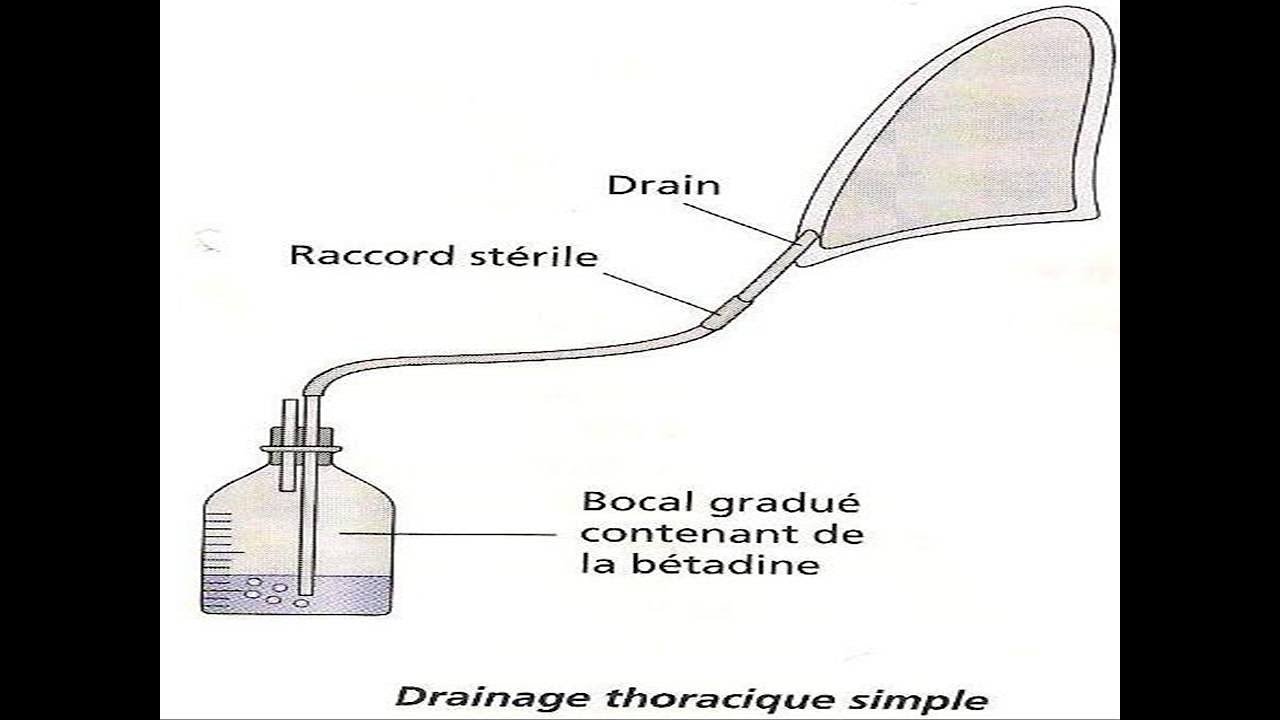 C'EST QUOI LE DRAINAGE ? - YouTube