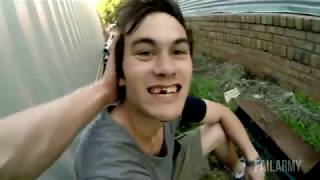 Parkour FAIL (Broken Teeth)