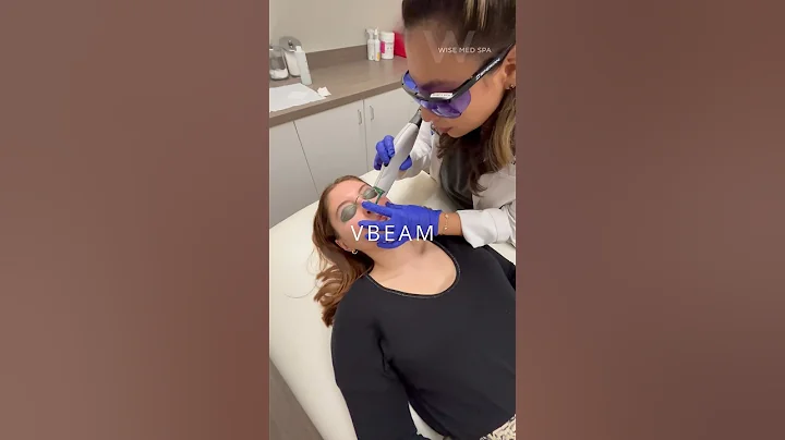 *Flash Warning* Treat rosacea with the VBeam Perfecta laser treatment at Wise Med Spa in Wayne, NJ!