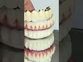 Preventing zirconia fractures