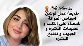 طريقة عمل لوشن احماض الفواكه |للقضاء على الكلف و تصبغات البشرة و الحبوب و تفتيح البشرة