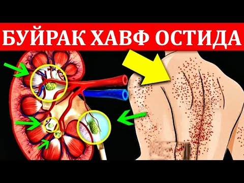 Video: Diagnostika skanerlash vositasi bo'lishi mumkinmi?