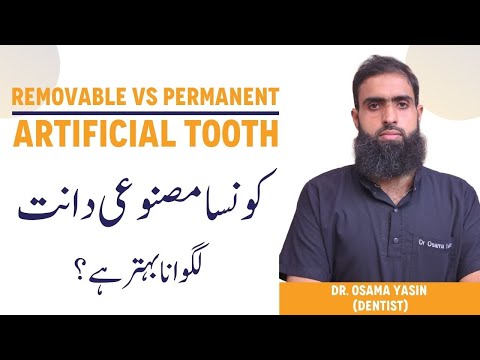 How to REPLACE a Missing Tooth – Removable vs Permanent Teeth – Konsa Daant Lagwana Chahiye? thumbnail image
