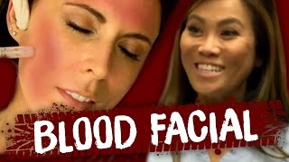 Blood Facial w/ DR PIMPLE POPPER!! (Beauty Trippin)(Watch last week's episode aka PIMPLE POPPING ▻▻ https://www.youtube.com/watch?v=DjBOYLF2K_U SUBSCRIBE for MORE beauty WEIRDNESS ..., 2016-11-24T16:00:01.000Z)
