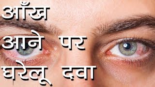 आख आन पर घरल दव Aankh Aana Treatment Conjunctivitis  Causes Of Eye Infection  Ayurvedic