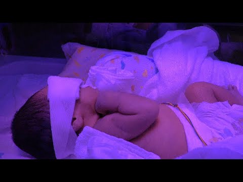 黄疸治療Day 9　　NICU　低出生体重児の成長記録 low weight birth infant