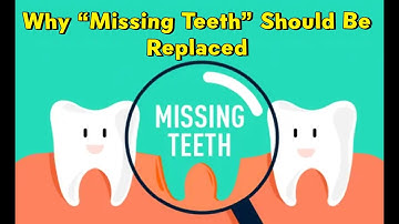 Why You Must Replace Missing Teeth