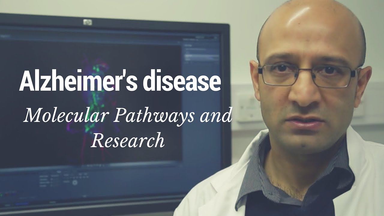 Alzheimer's disease - Molecular pathways and research
