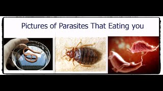 What's Eating You? Pictures of Parasites..تعؤف على الديدان والحشرات التى تتغذى على جسدك