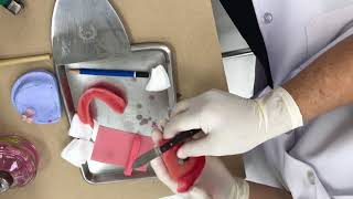 CD try in bite block 9/10