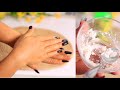 How to Make Your Hands Look 5 Years Younger | Wrinkle-Free hands