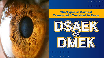 The Types of Corneal Transplants You Need to Know  - DSAEK vs DMEK