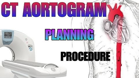 CT AORTOGRAM : planning and procedure explained