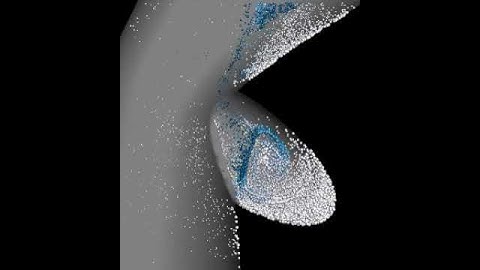 Flow in a carotid plaque ulcer - downwards orientation