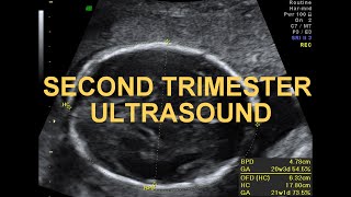 SECOND TRIMESTER ULTRASOUND -WITH PICTURES MADE EASY FOR STUDENTS