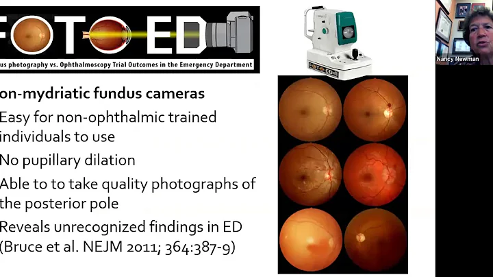 Neuro-Ophthalmol...  Update: Zoom Conference