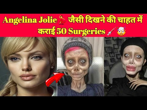 Angelina Jolie💃 जैसी दिखने की चाहत में कराई 50 Surgeries 💉🤯 | Sahar Tabar | #shorts #angelinajolie