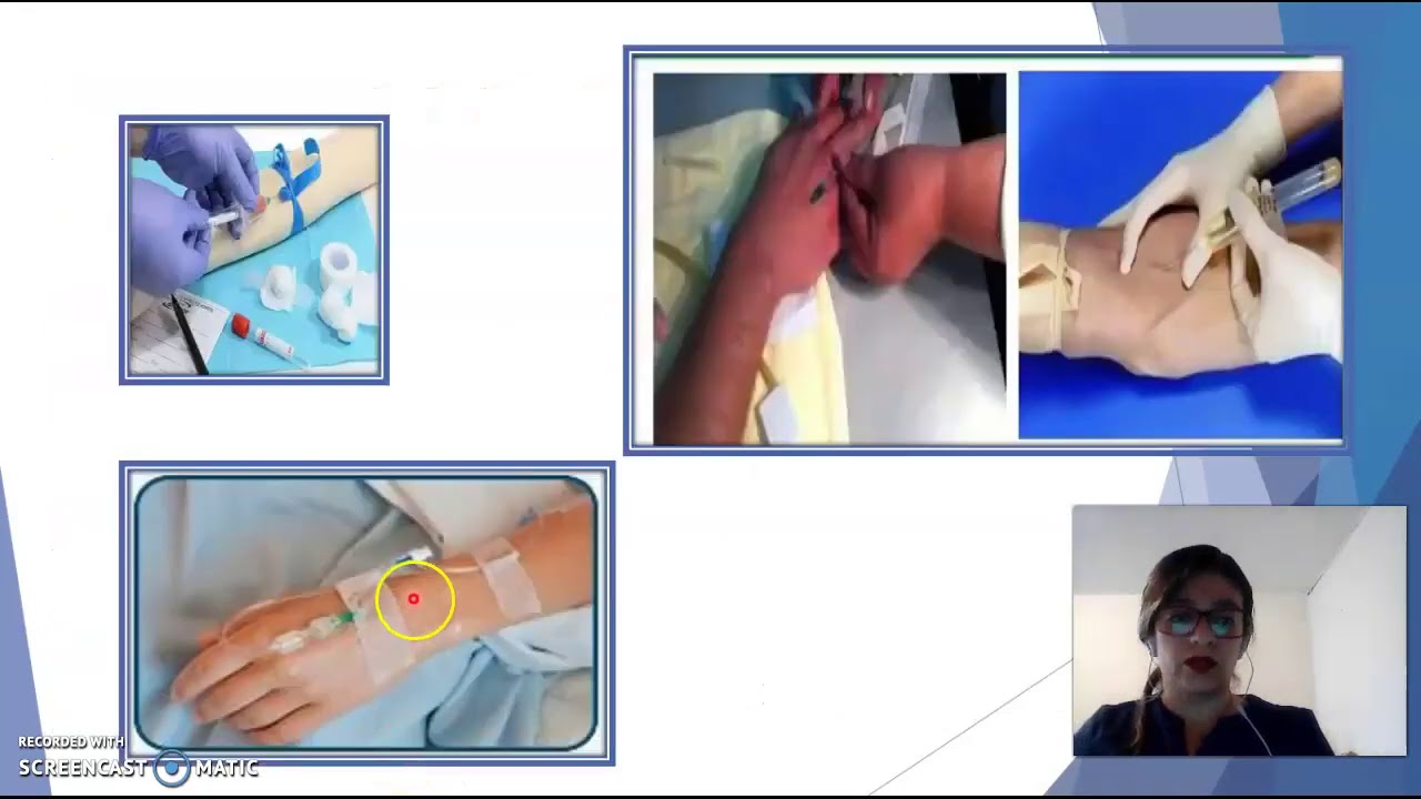 Conceptos basicos de Enfermeria Grupo154005 15 YouTube