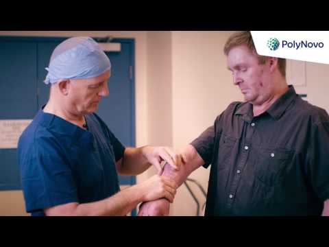 PolyNovo Corporate video