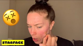 STARFACE REVIEW!?