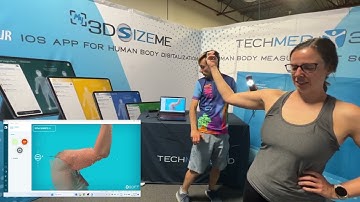 Elbow scanning with MSoft and the Einstar scanner