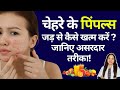 चेहरे के पिंपल्स जड़ से कैसे खत्म करें? जानिए असरदार तरीका!