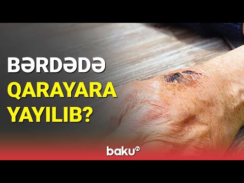 Bərdədə qarayara yayılıb? - BAKU TV