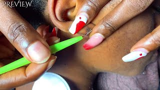 Asmr Satisfying Ear Cleaning On A Real Person, Back, Eyebrows, Ear Eating Licking, Whispering