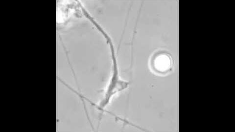 Growth Cones-turning and actin dynamics.m4v