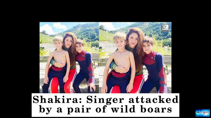 Shakira: Singer attacked by a pair of wild boars