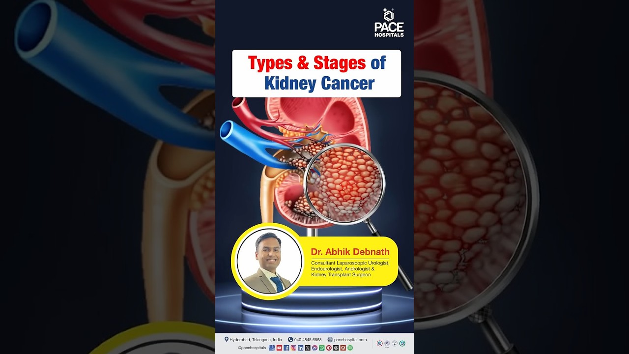 Kidney Cancer (Renal Carcinoma) - Type & Stage | Type of Kidney Cancer | Stage of Kidney Cancer