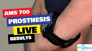 Inflatable Penile Prosthesis | AMS 700 Cx inflation Live results