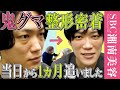 【目の下のクマなくす整形】腫れやダウンタイムはこんな感じでした【メンズ・男性クマ取り】湘南美容クリニック