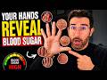 What Your HANDS Are Telling You About Your Blood Sugar