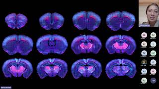 Insight into Imaging and Analysis in Neuroscience