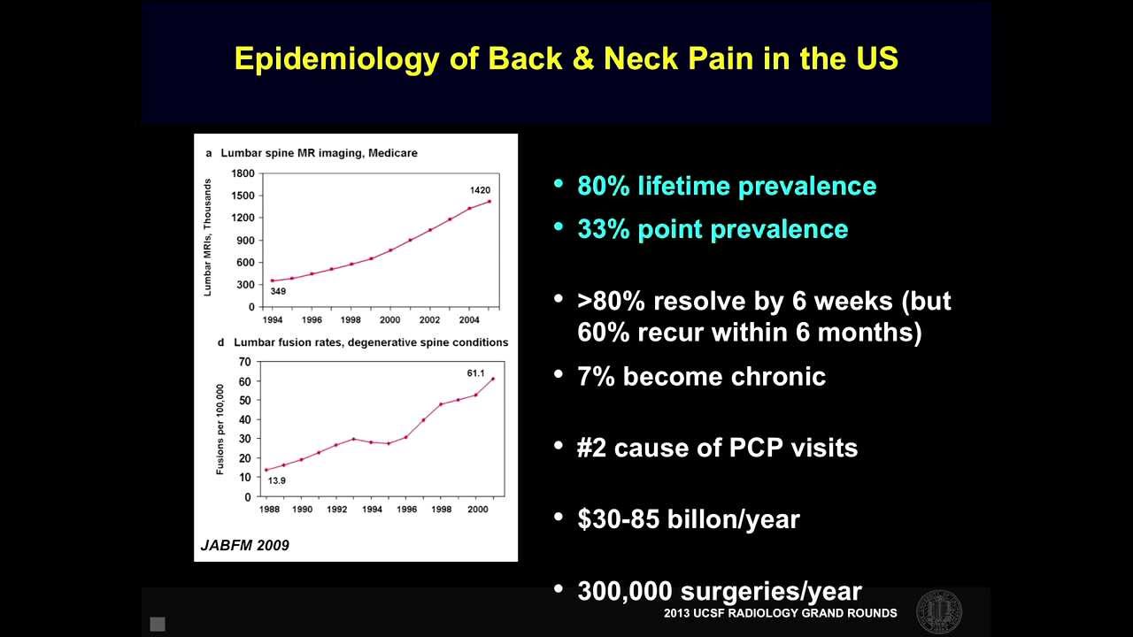 UCSF Radiology: The Prevalence of Back Pain