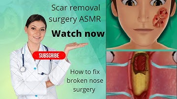 scar revision surgery||broken nose|| Surgery|| plastic surgery||ASMR||animation