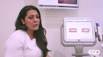How long does Invisalign treatment take? | Invisalign Q&A