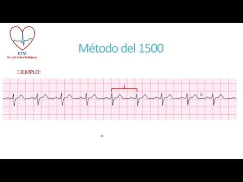 como medir frecuencia cardiaca en electrocardiograma