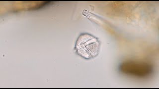Dinoflagellate - Protoperidinium sp.
