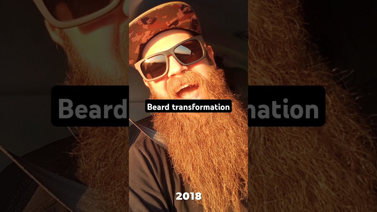 From Brittle Beard to Braw Beard 