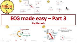 ECG made easy - Part 3/ Cardiac axis