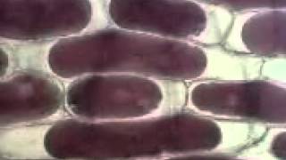 Plasmolysis onion cells