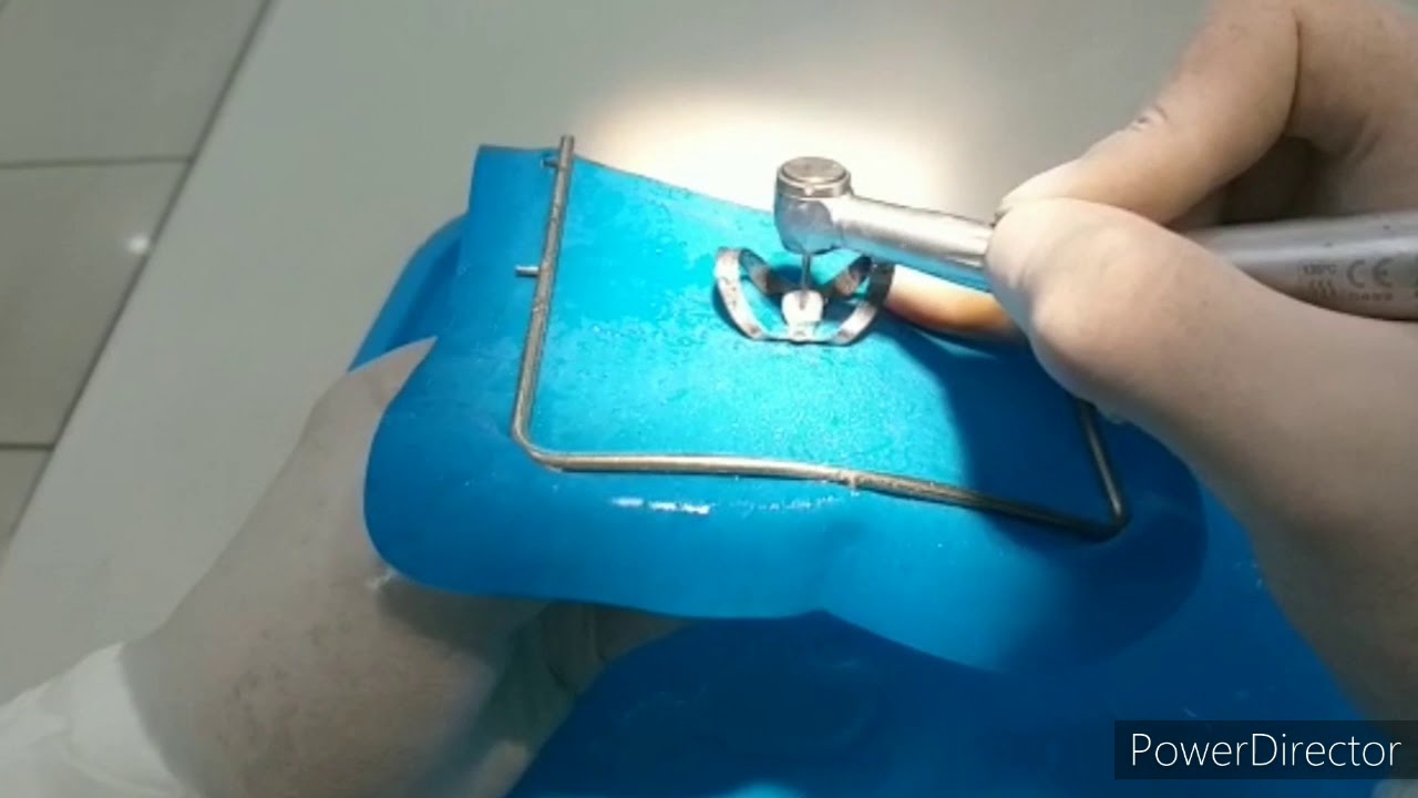 Endodontia em Dentes Decíduos