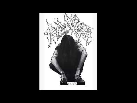 Bones - BarbwireRibCage (FUEL FLIP) - YouTube
