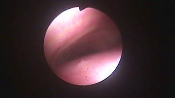 Veterinary Bronchoscopy#460, Dynamic Tracheal Collapse and Pharyngeal Obstruction, Toy Poodle 12y M